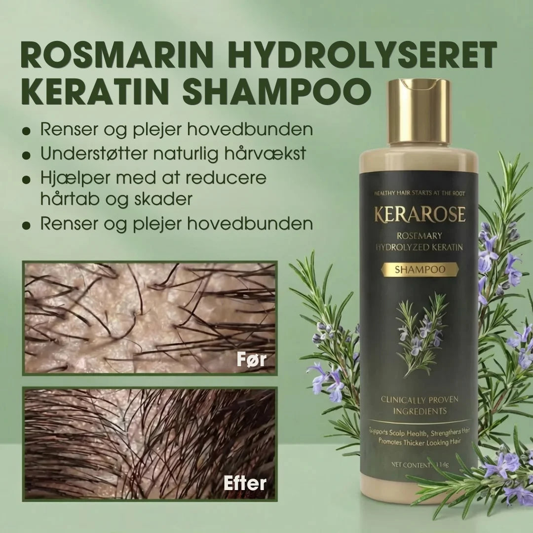 KeraRose™ – Rosmarin shampoo – 1+1 GRATIS