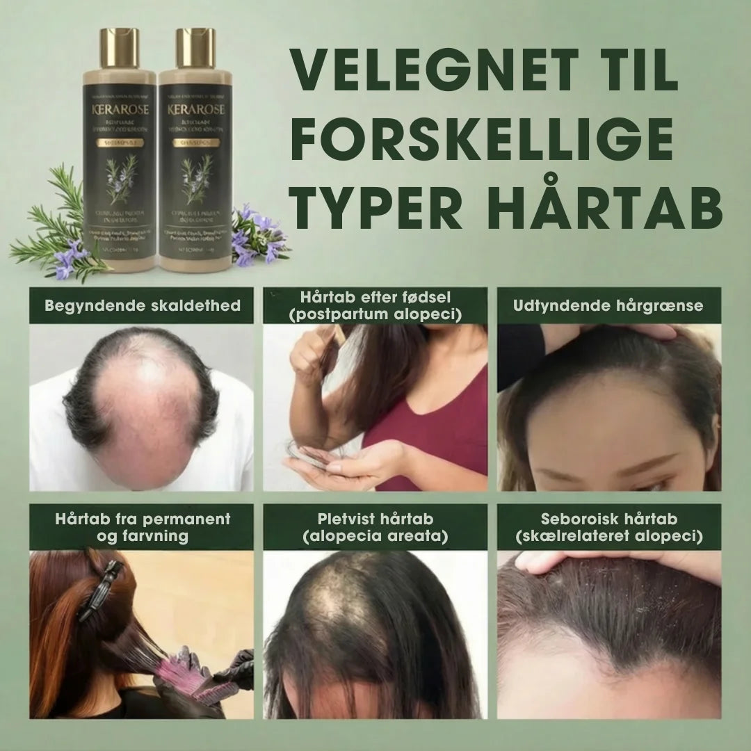 KeraRose™ – Rosmarin shampoo – 1+1 GRATIS