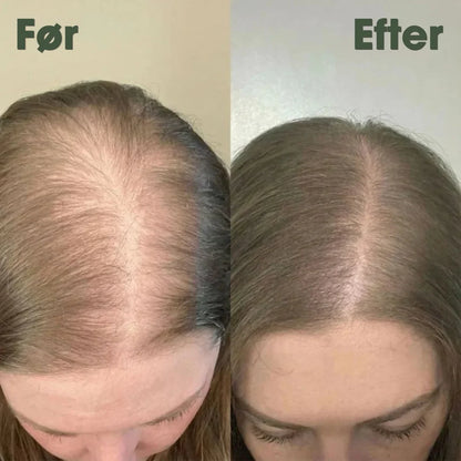 KeraRose™ – Rosmarin shampoo – 1+1 GRATIS