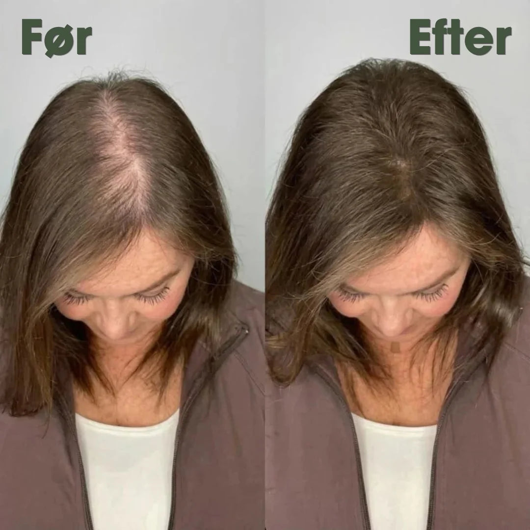 KeraRose™ – Rosmarin shampoo – 1+1 GRATIS