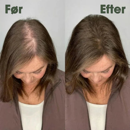 KeraRose™ – Rosmarin shampoo – 1+1 GRATIS